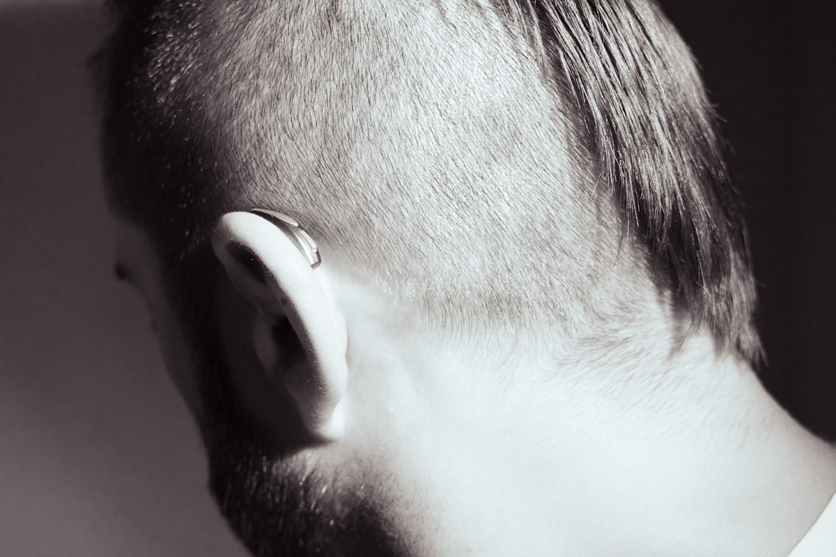 Hair Transplant Results in Turkey: What to Realistically Expect