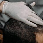 Specialist examining scalp and hair during a consultation