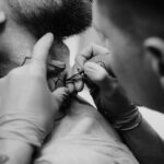 Close-up of a hair transplant procedure with surgical gloves
