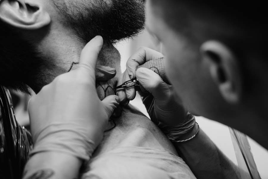 Close-up of a hair transplant procedure with surgical gloves